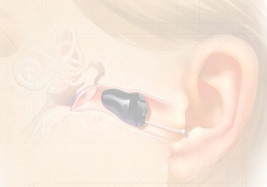 Iic Light hearing aid